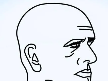 AD SE - Ch 8 Attention Is Not Localized