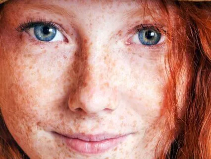 Anne Of Avonlea (Bedtime Story) Chapter 22