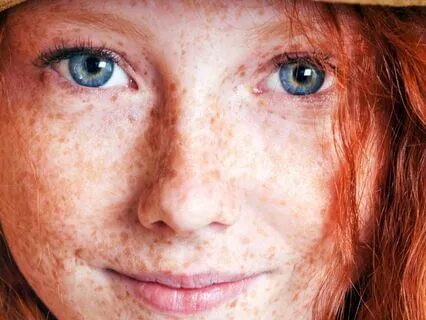 Anne Of Avonlea (Bedtime Story) Chapter 25