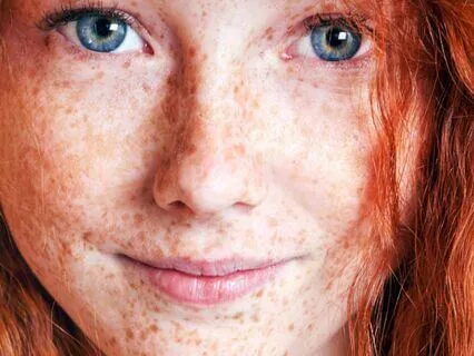 Anne Of Avonlea (Bedtime Story) Chapter 29