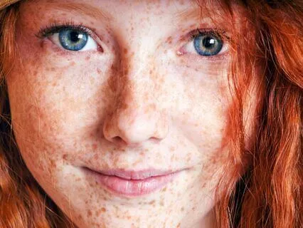 Anne Of Avonlea (Bedtime Story) Part 12