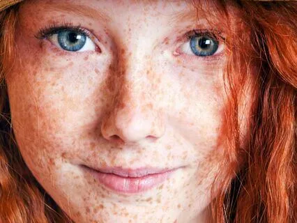 Anne Of Avonlea (Bedtime Story) Part 13