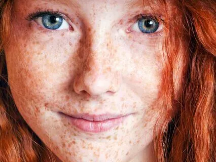 Anne Of Avonlea (Bedtime Story) Part 14