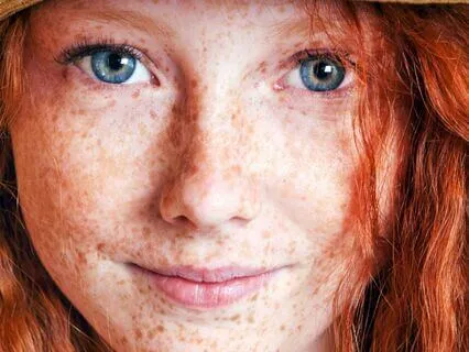 Anne Of Avonlea (Bedtime Story) Part 15