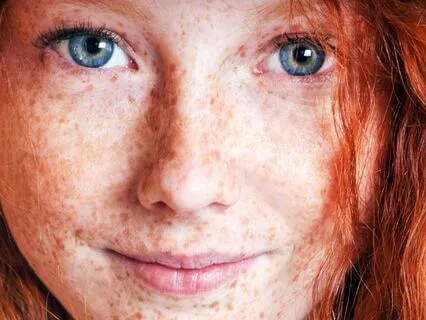 Anne Of Avonlea (Bedtime Story) Part 17