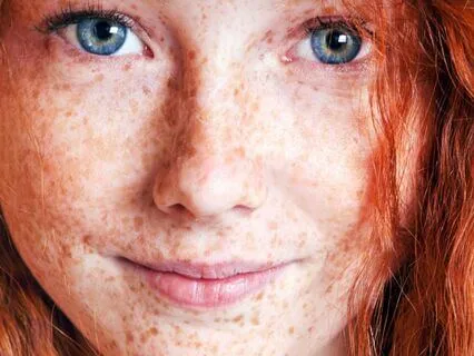 Anne Of Avonlea (Bedtime Story) Part 20