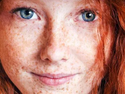 Anne Of Avonlea (Bedtime Story) Part 21