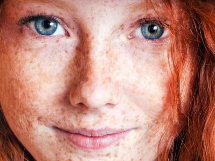 Anne Of Avonlea (Bedtime Story) Part 23