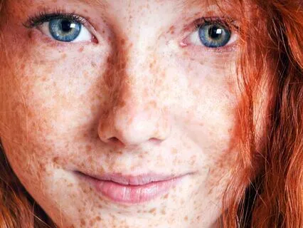 Anne Of Avonlea (Bedtime Story) Part 24