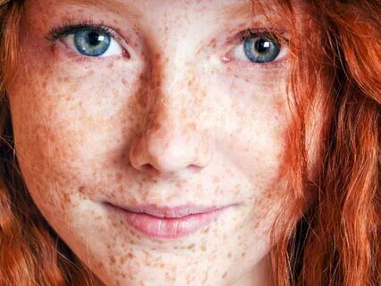 Anne Of Avonlea (Bedtime Story) Part 3