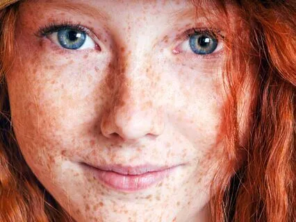 Anne Of Avonlea (Bedtime Story) Part 5