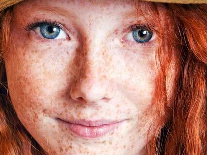 Anne Of Avonlea (Bedtime Story) Part 6