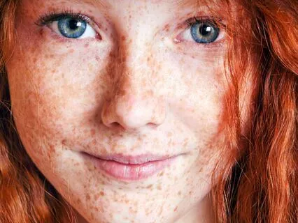 Anne Of Avonlea (Bedtime Story) Part 7