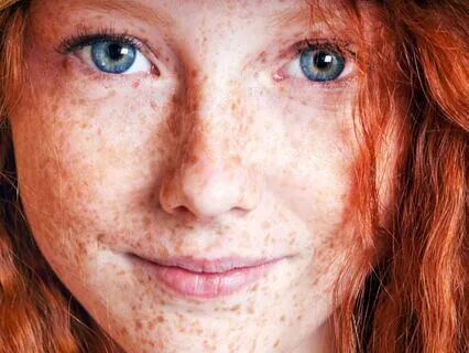 Anne Of Avonlea (Bedtime Story) Part 8