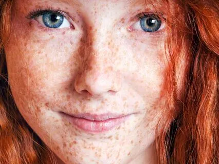 Anne Of Avonlea (Bedtime Story) Part 9