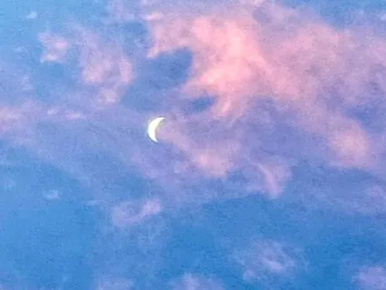 Embody Radical Acceptance For Self Compassion And Healing