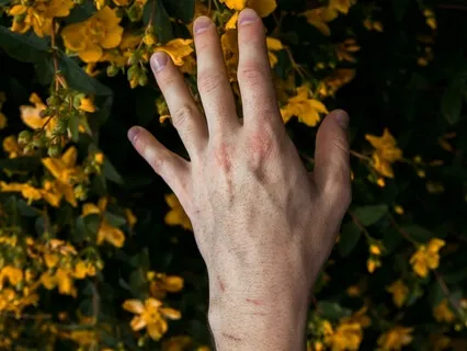 Expanding Lovingkindness