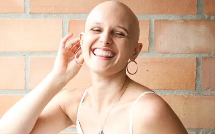 Feel Empowered Through Hairloss (Alopecia)