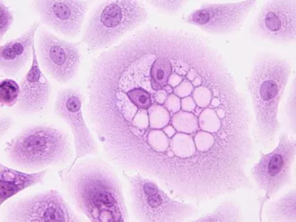 Healing Support For The Cancer Journey