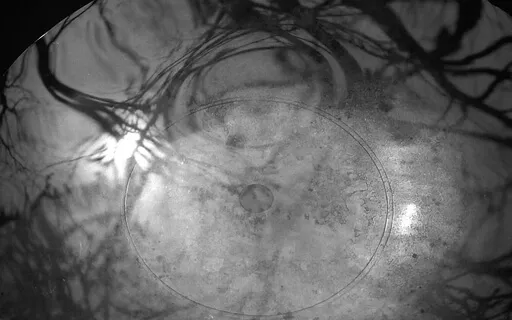 Liminal Prayer - Day 10