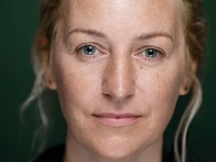 Not Wanting To Be Alive And Not Wanting To Die: Part 2