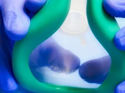 Surrendering To Anesthesia