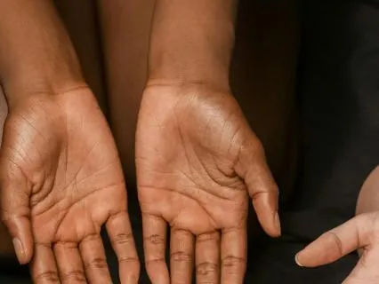 The Art Of What Is: Acceptance