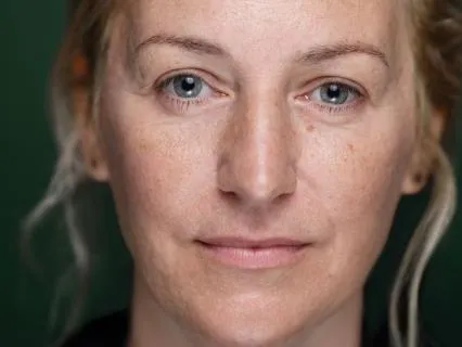 The Cost Of Staying: Why Appeasement Breaks The Body