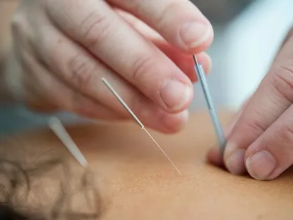 The History Of Acupuncture And Marma Points And How We Can Use Them