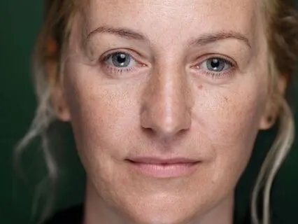 When Self-Care Turns Into Fascism