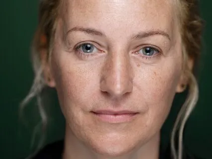 Cost Of Being Told To ‘Just Forgive’: Bypassing & Whiteness